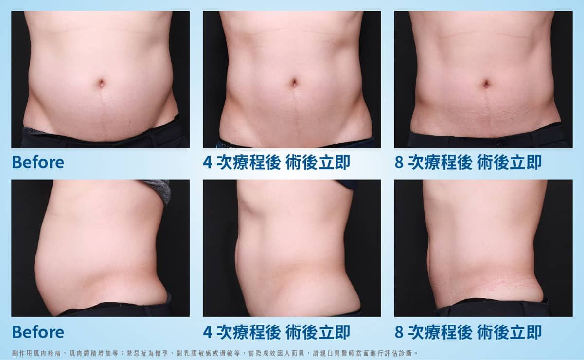 萊波亞