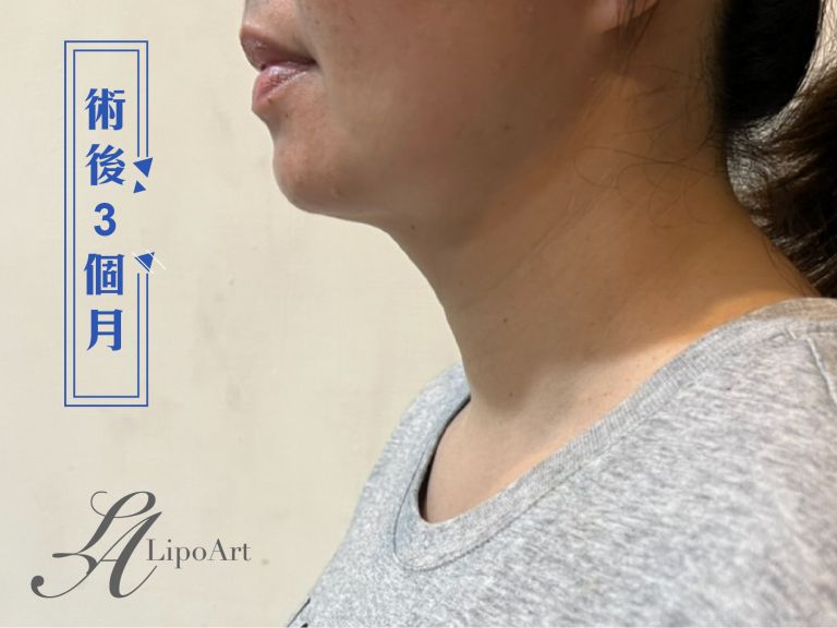 萊波亞