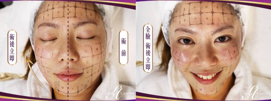 萊波亞