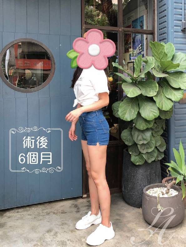 萊波亞