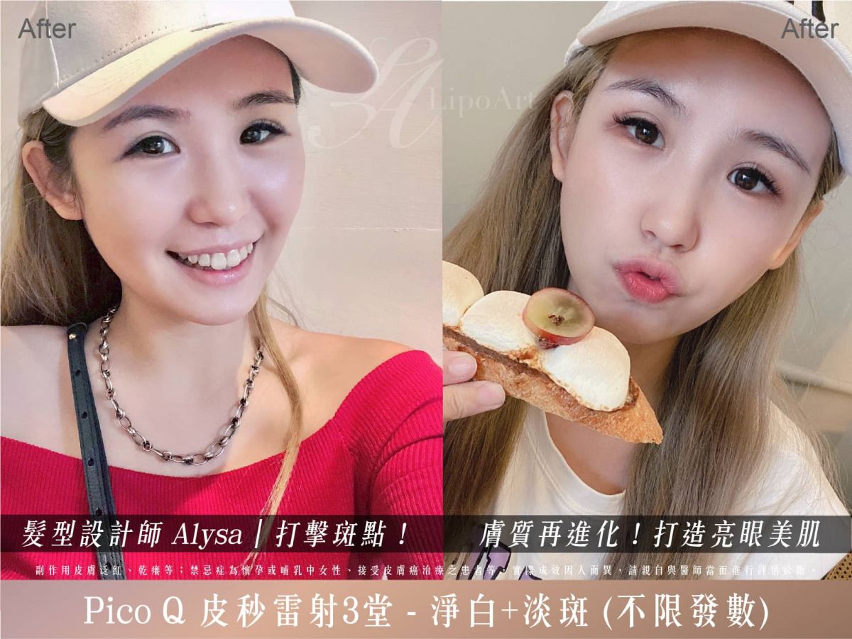 萊波亞