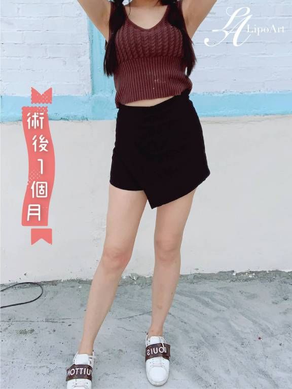 萊波亞