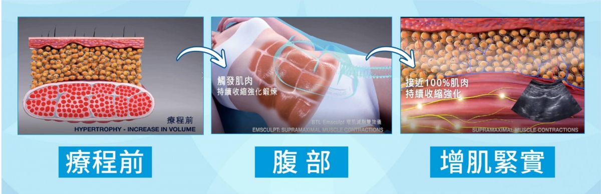 萊波亞