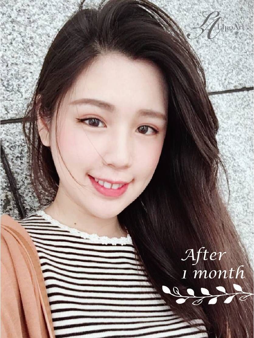 萊波亞