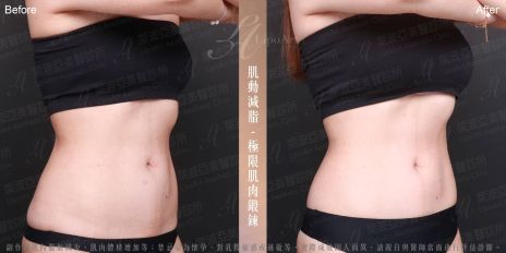 萊波亞