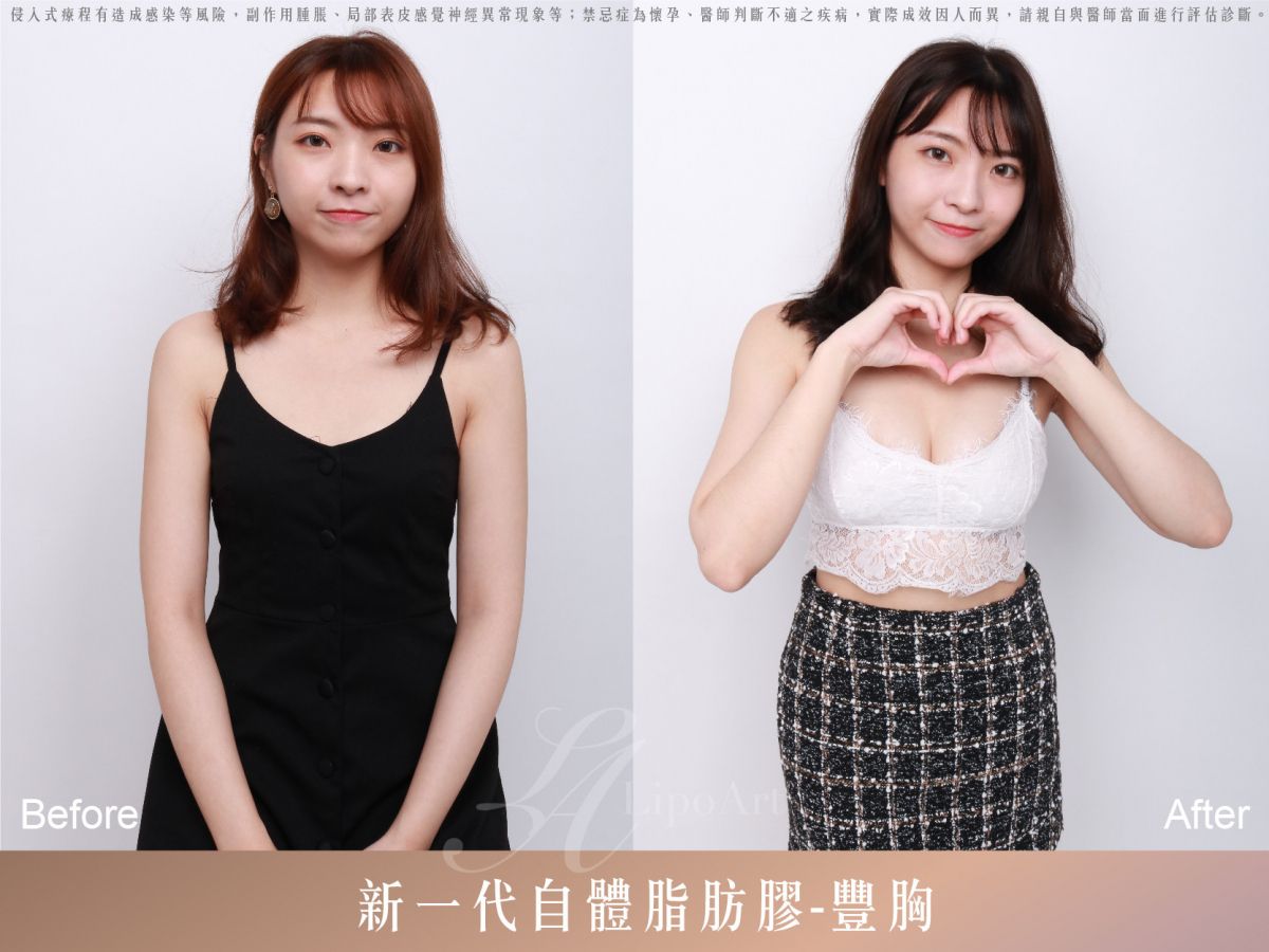 萊波亞