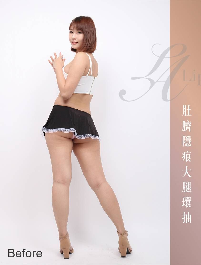 萊波亞 