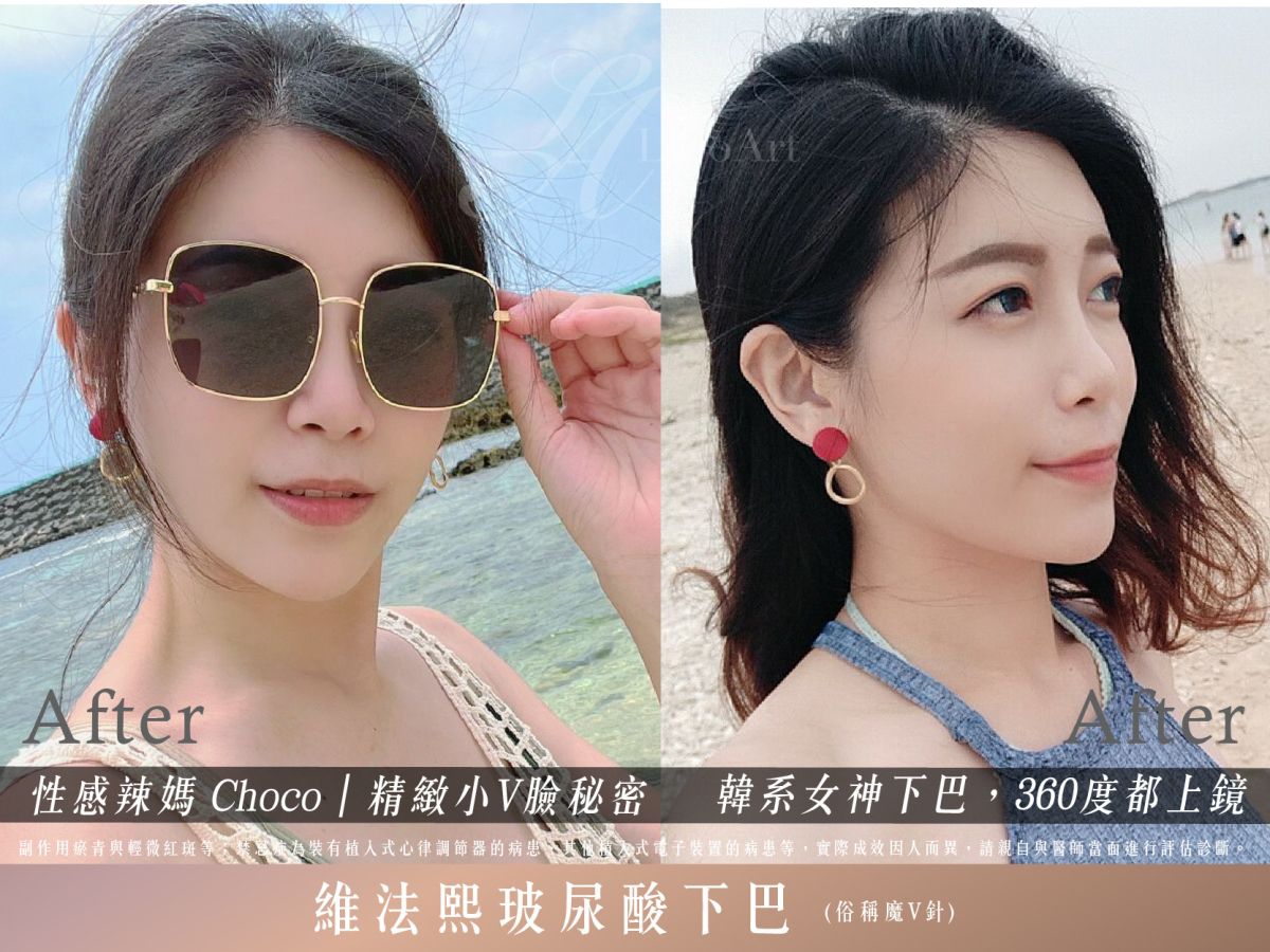 萊波亞