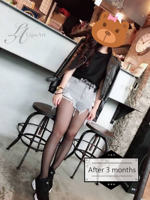 萊波亞