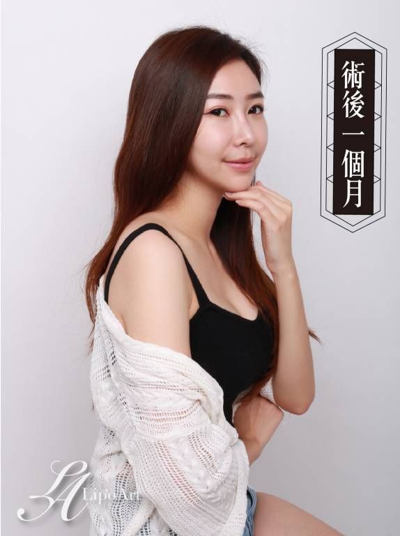 萊波亞