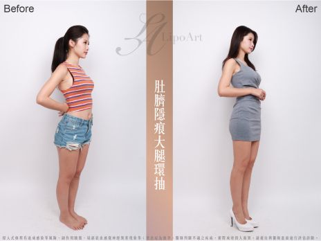 萊波亞 