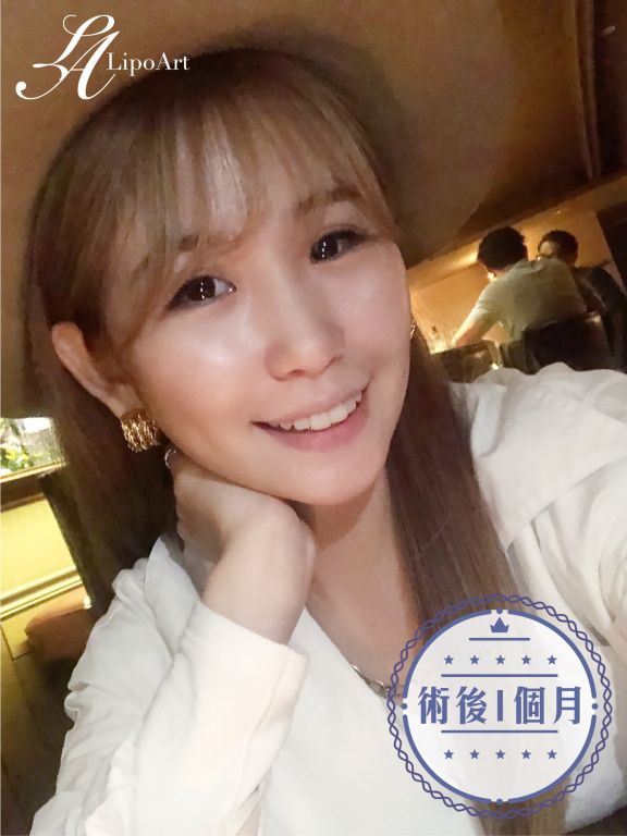 萊波亞