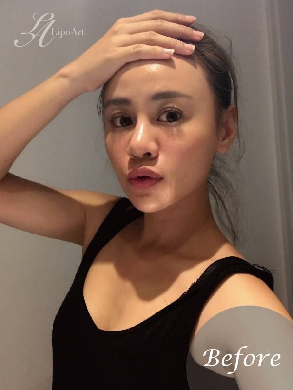 萊波亞