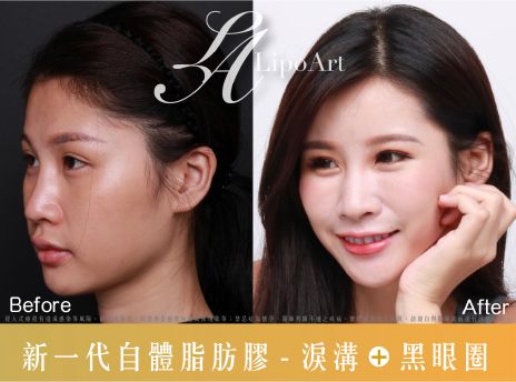 萊波亞 