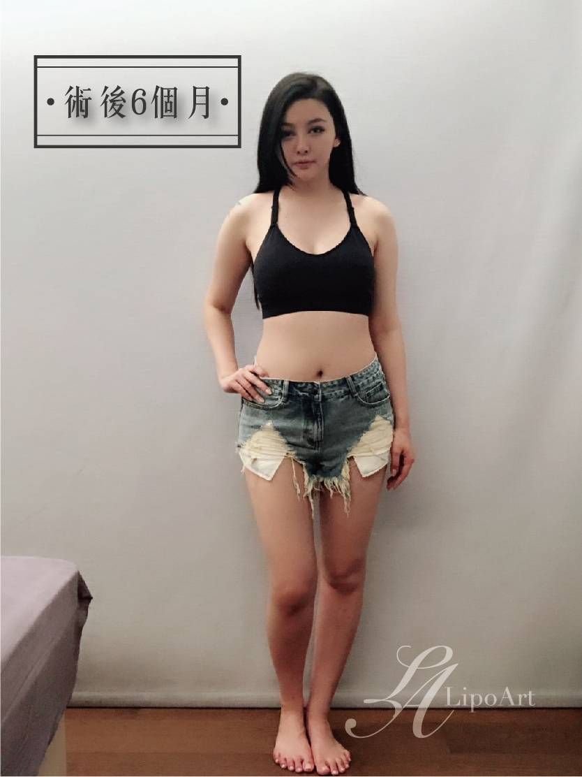 萊波亞 