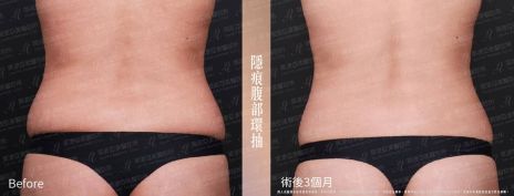萊波亞 