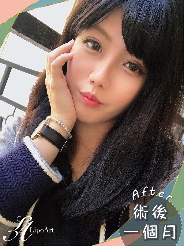 萊波亞