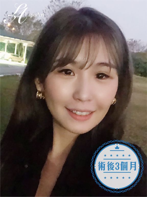 萊波亞