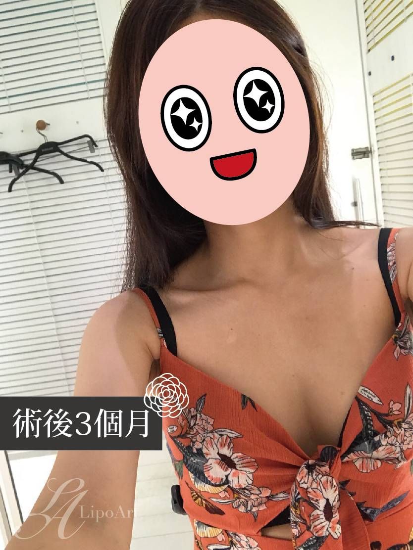 萊波亞