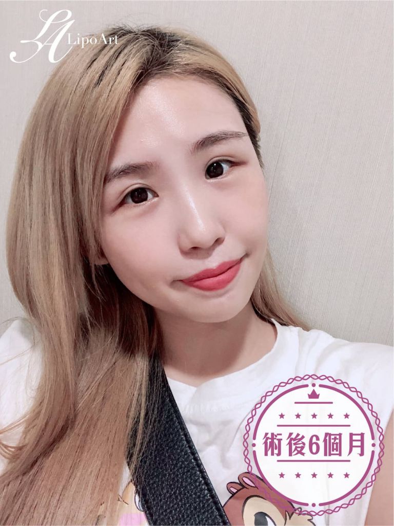 萊波亞