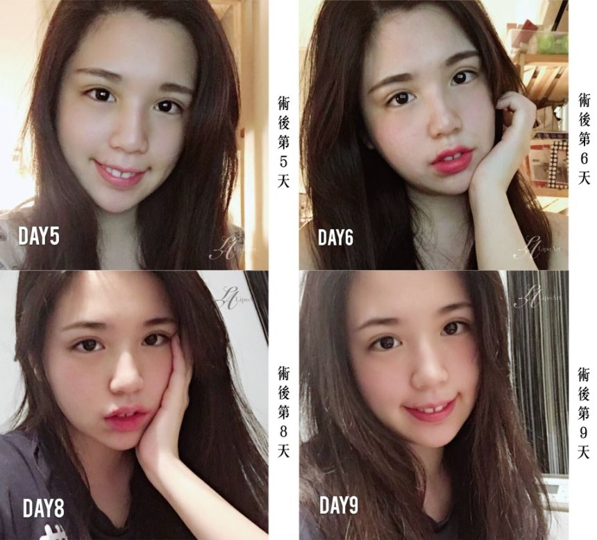萊波亞
