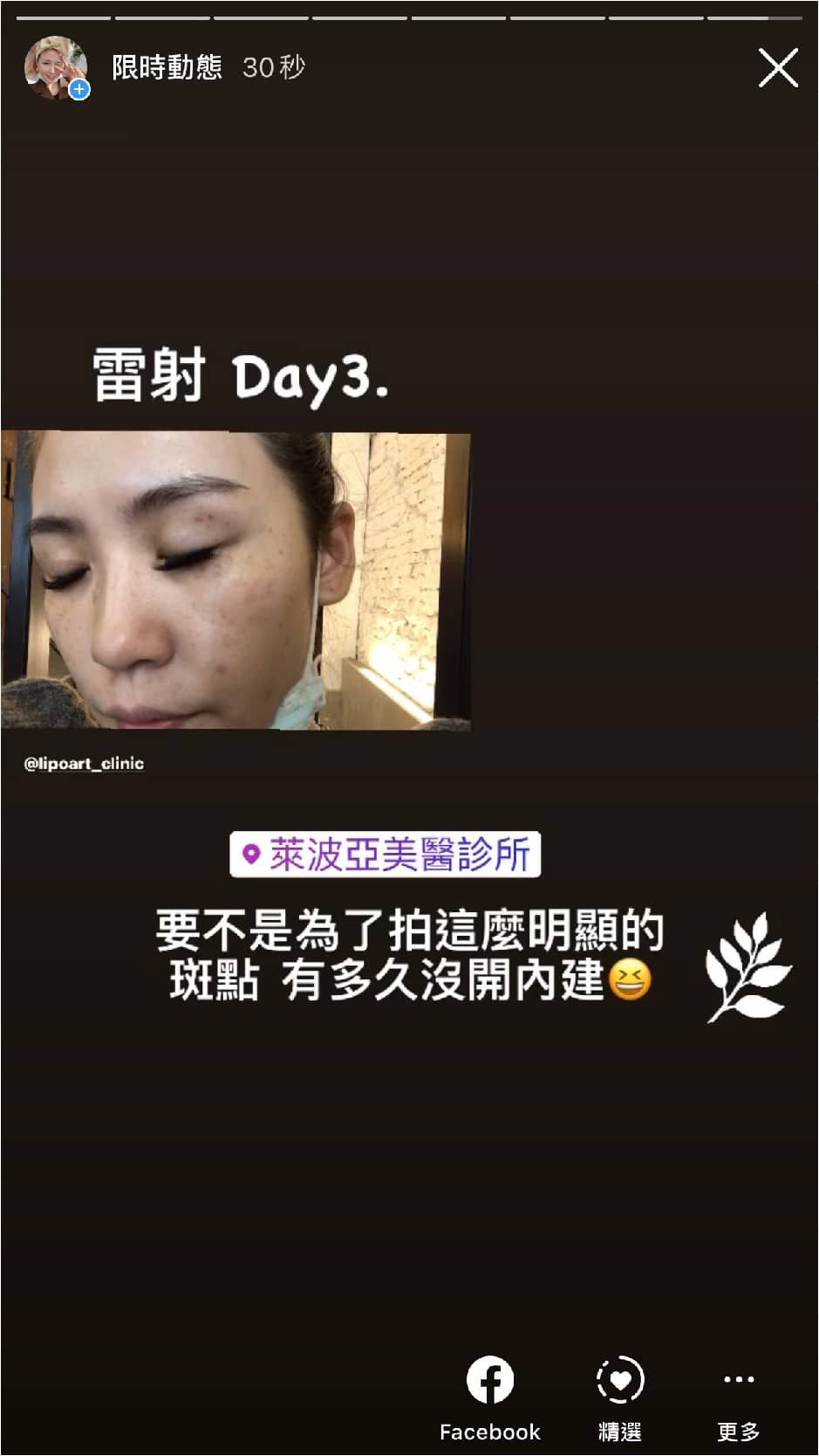 萊波亞