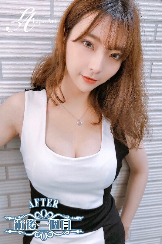 萊波亞