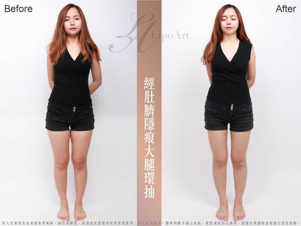 萊波亞