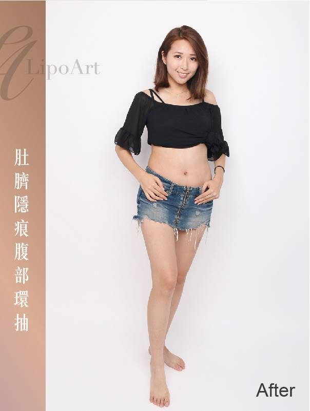 萊波亞