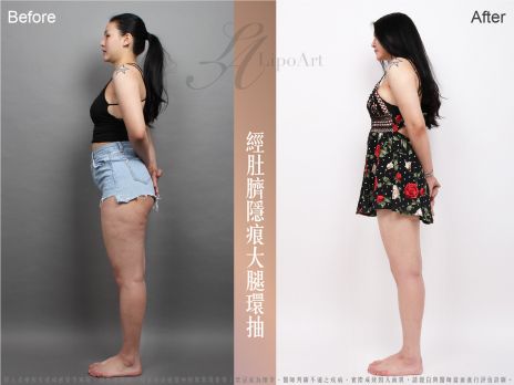 萊波亞 