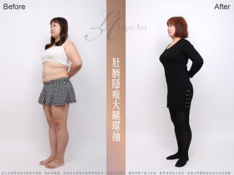 萊波亞