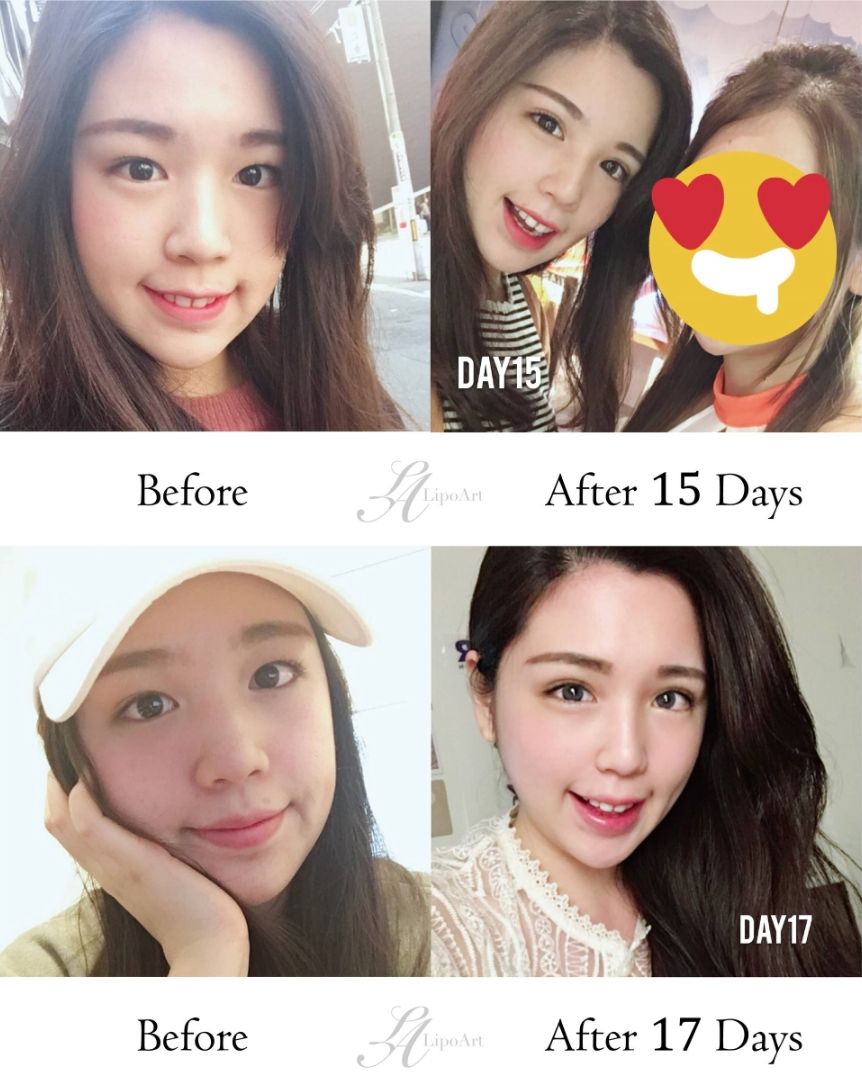萊波亞