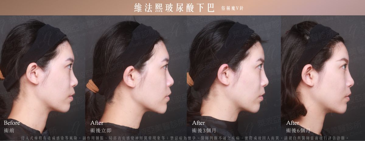 萊波亞