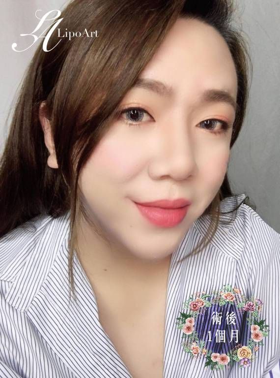 萊波亞