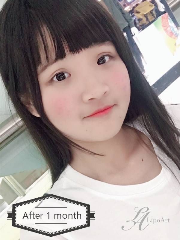 萊波亞