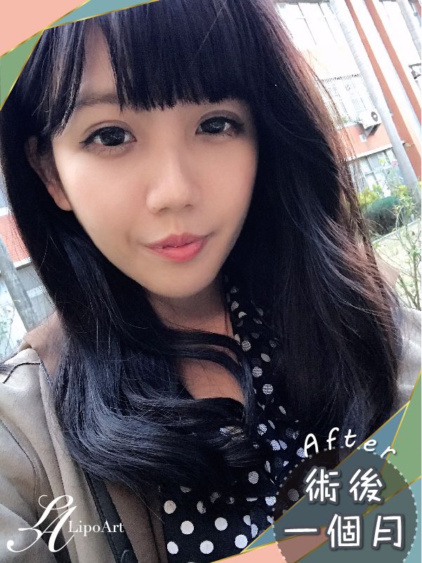 萊波亞
