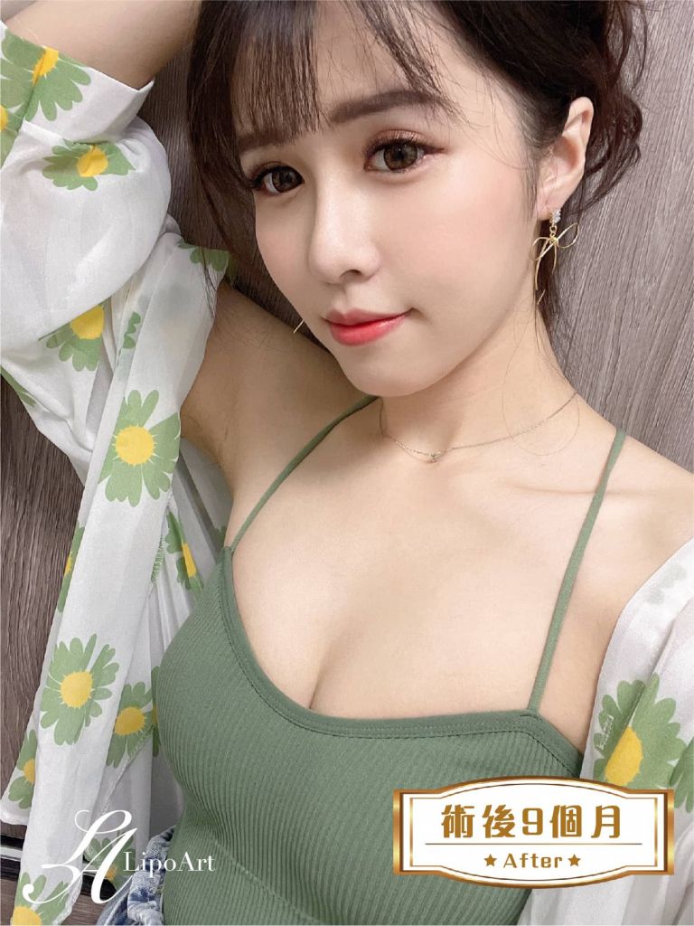 萊波亞
