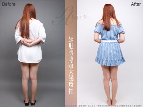 萊波亞 