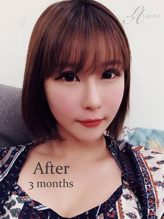 萊波亞