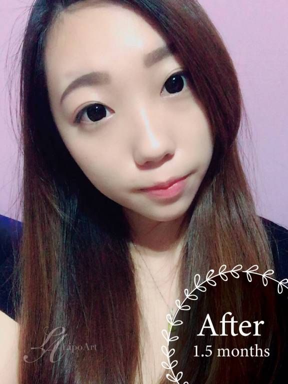 萊波亞