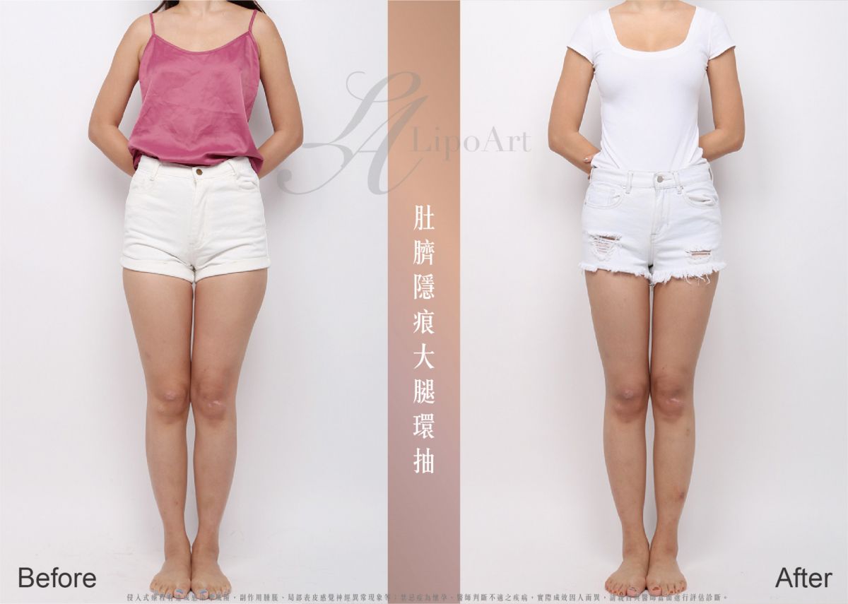萊波亞