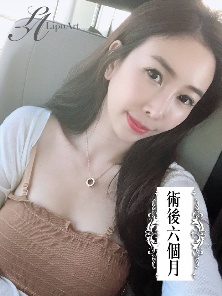 萊波亞