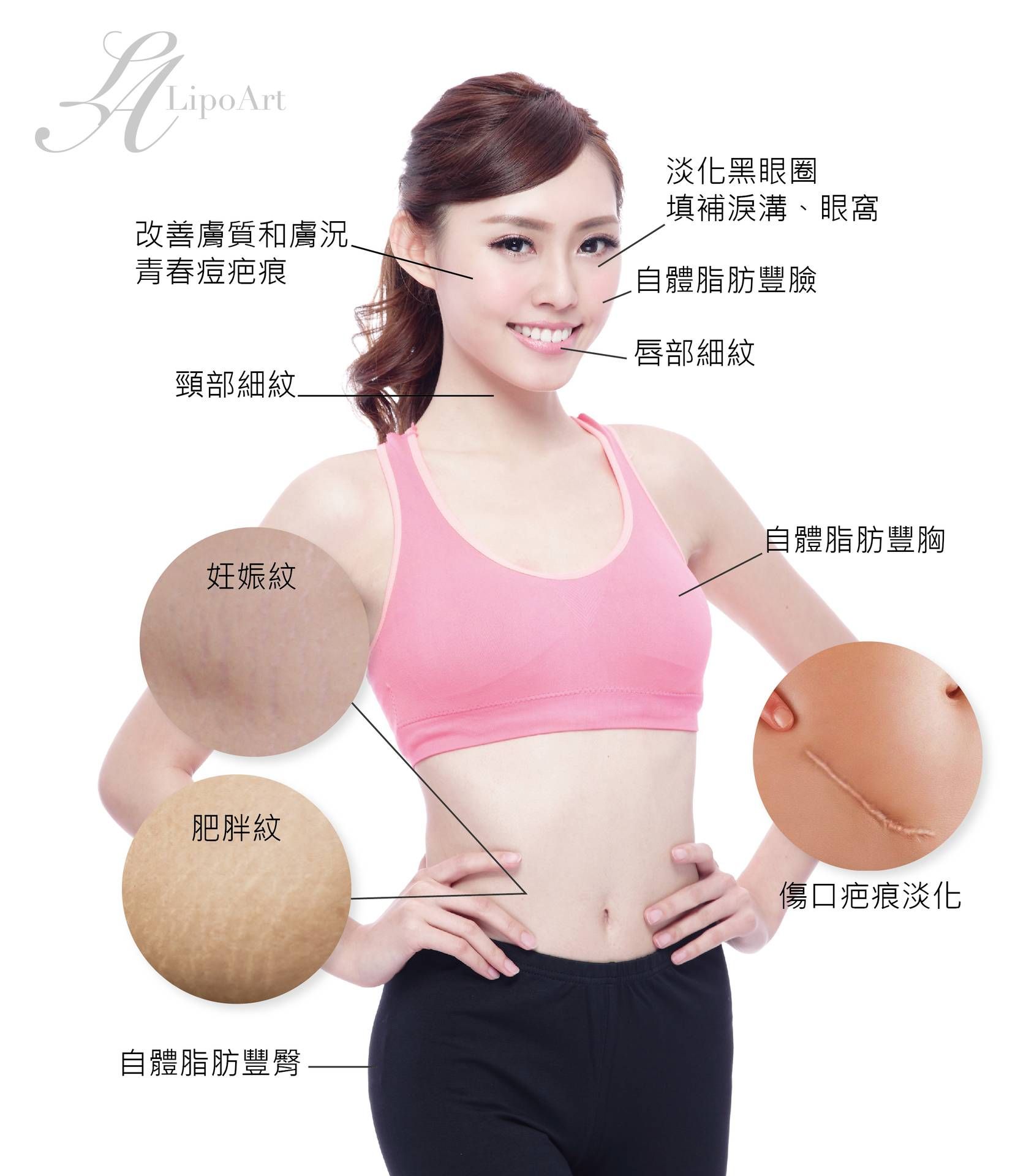 萊波亞