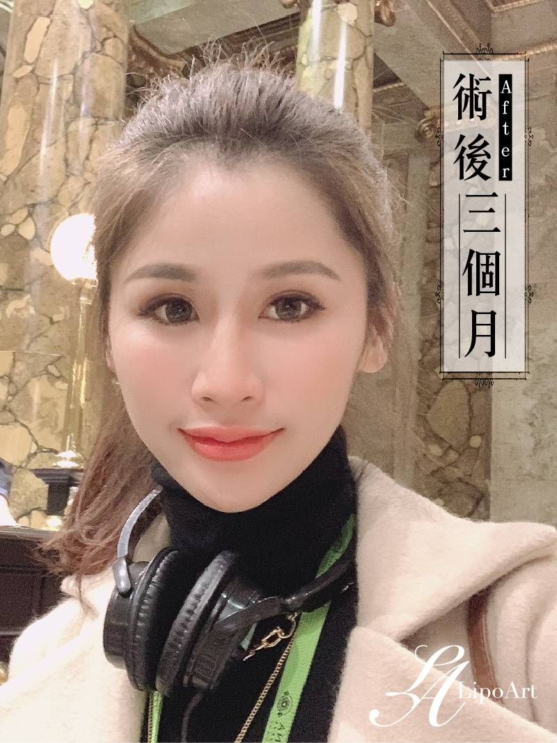 萊波亞