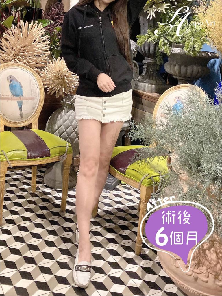 萊波亞