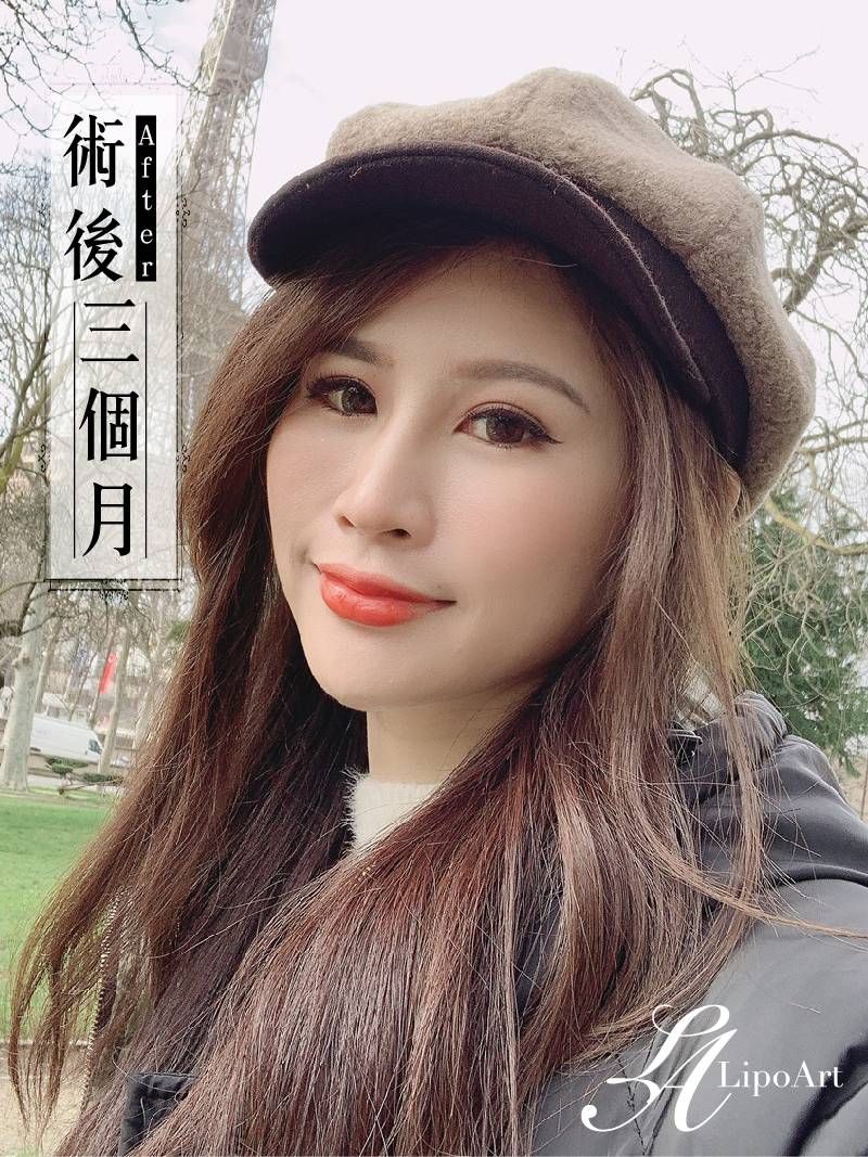 萊波亞
