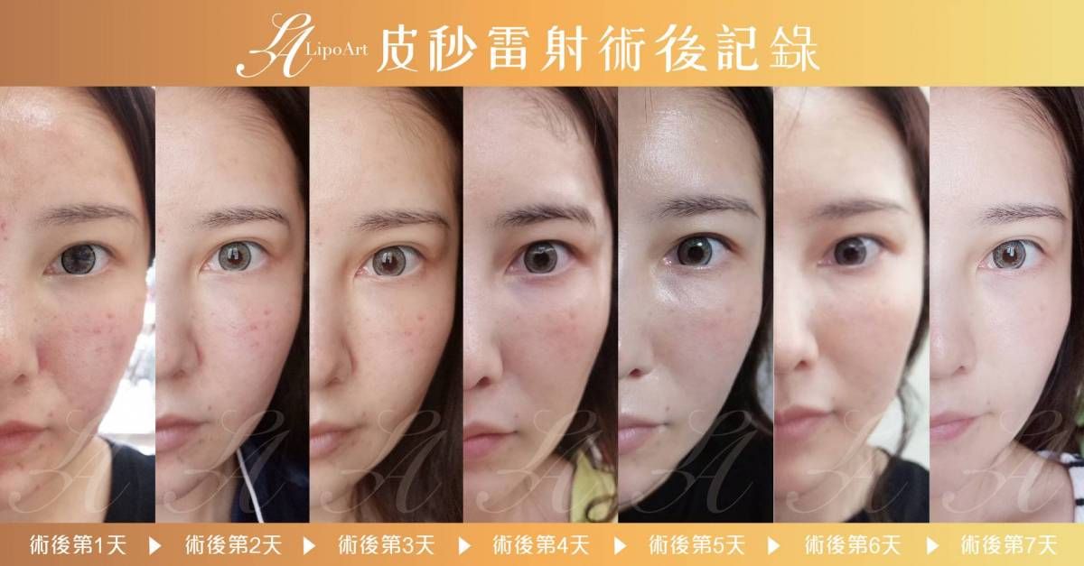 萊波亞