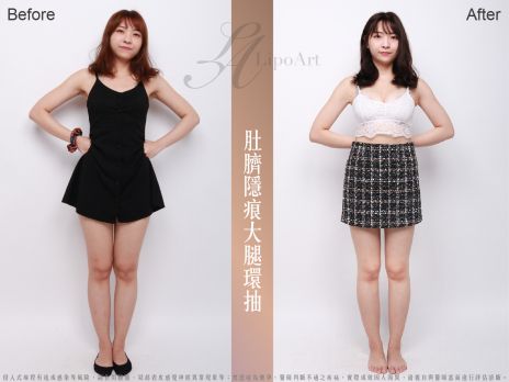 萊波亞 