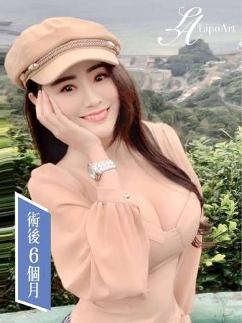 萊波亞