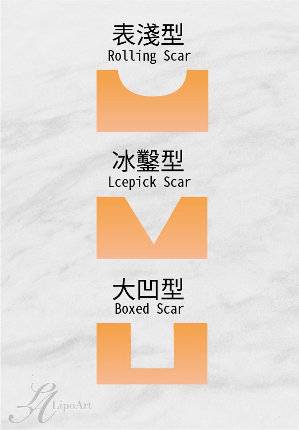 萊波亞